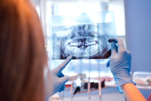 Close up female dentist pointing at patient's X-ray image in dental office.