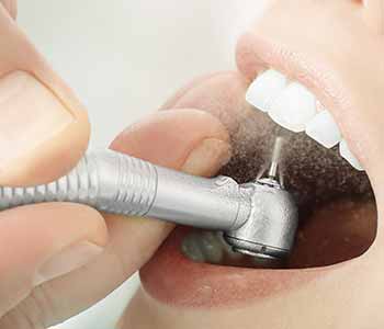 Enjoy professional teeth cleanings on Saturdays at Franklin, OH dental practice