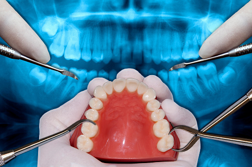 orthodontics surgery simulation